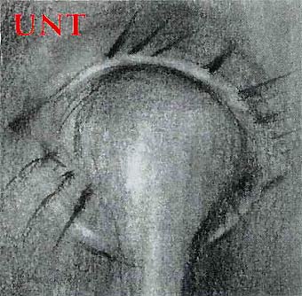 Penthouse - UNT - LP (2002)